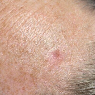 Red Spots